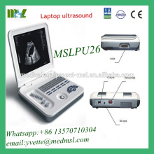 MSLPU26M Portable ultrasound machine with High-speed USB